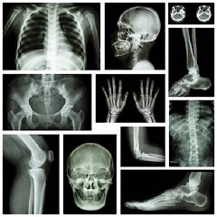 X RAY Interpretation – cases